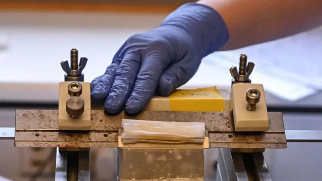 विज्ञहरूका अनुसार उक्त सङ्कलनमा भएका मानव मस्तिष्कबाट डिमेन्श अर्थात् विस्मृति र डिप्रेशन अर्थात् अवसादजस्ता रोगहरूको अध्ययन गर्न सहयोग पुगेको छ। 