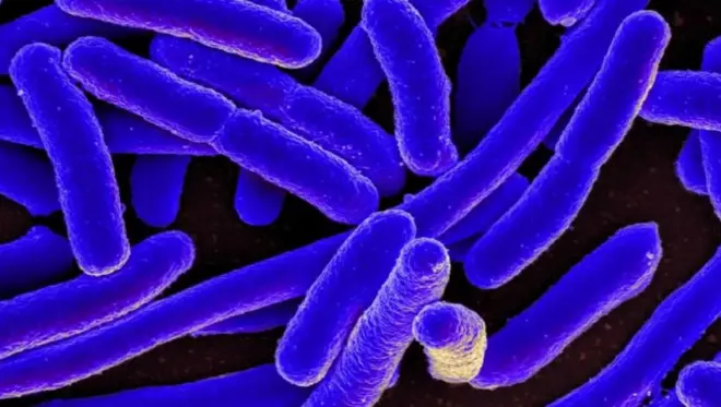 Imagen de E. coli en azul y negro
