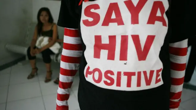 HIV
