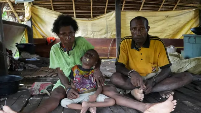 Keluarga Maurenus Merne tinggal di Kampung Anggreso, Kabupaten Mamberamo Raya. Anak bungsunya, Petra, lumpuh sejak balita dugaannya selama mengandung, mama Ester tidak mendapatkan asupan makanan bergizi dan vitamin yang memadai.