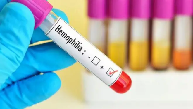हिमोफिलिया, आरोग्य, रक्त