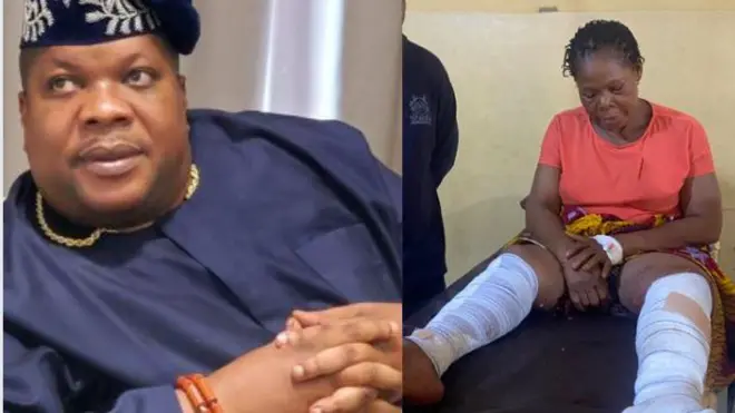 Oriade ati ẹni to farapa nibi ikọlu