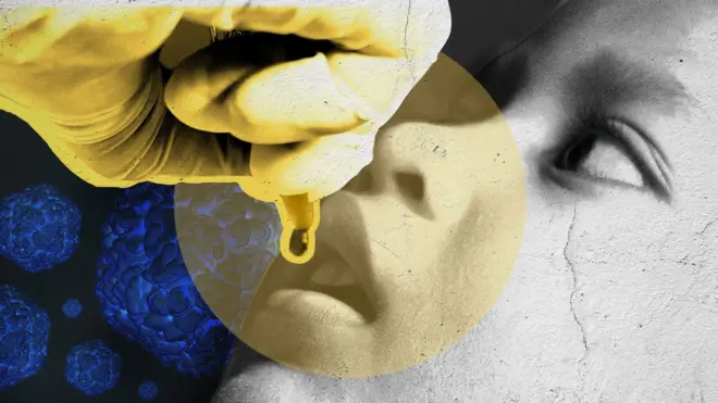 Photo d’une enfant recevant des gouttes contre la poliomyélite