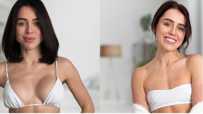 Katerina Kurupkina, meme implantlarını ve dudak dolgularını çıkardı. Önce ve sonrasını gösteren fotoğraflar.