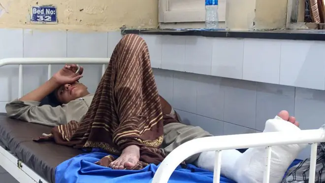 Injured Afghan man receive treatment for hospital afta earthquake for Afghanistan Jalalabad on September 1, 2025.