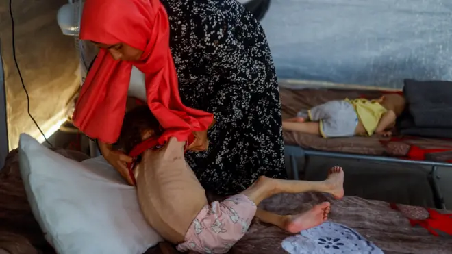 طفل يعاني من المجاعة 