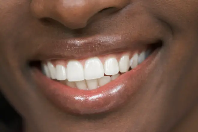 Un sourire qui fait apparaitre une dentition normale