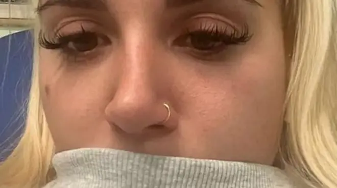 تقيأت مادي حمض المعدة والدم والرغوة البيضاء بعد تناول نسخة غير معتمدة من الدواء