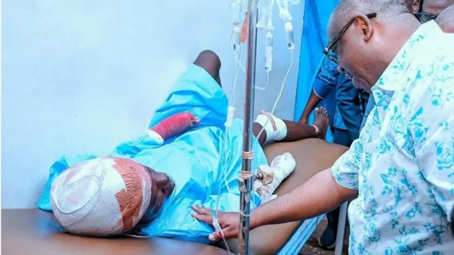 Gomina Caleb Mutfwang ti ipinlẹ Plateau wọ asọ shaati ati sokoto alawọ buluu, n fi ọwọ kan ọkunrin kan to sun sori ibusun nile iwosan, wọn fi ọpọ bandeji yi ori, ẹsẹ ati ọwọ rẹ, ti wọn si n fa omi si lara.