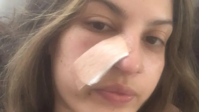 Daiane Lima com curativo durante a recuperação da cirurgia