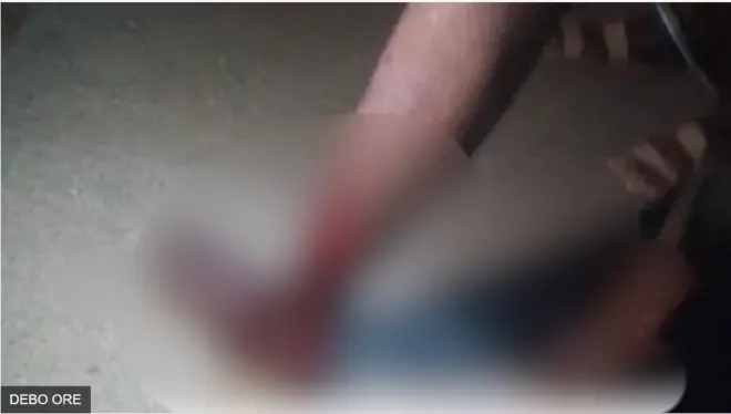 Mama arúgbó tí ajínigbé yín ìbọn mọ́ ni ilu Ìsapá nipinlẹ Kwara àfihàn kokosẹ rẹ to ń ṣe ẹ̀jẹ̀ láti ojú ọgbẹ ìbọn náà.