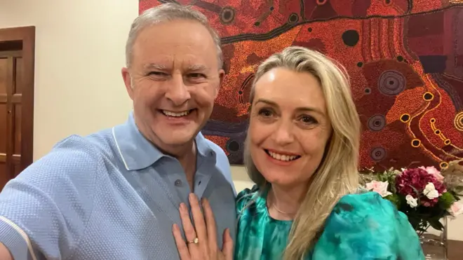 एंथनी अल्बनीज़