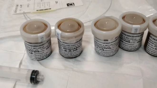 మలం నమూనాలు