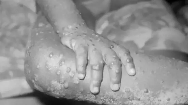 meymunçiçəyi Azərbaycan