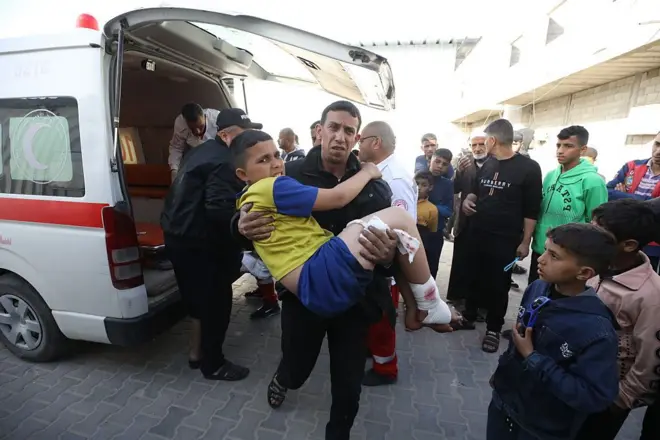 طفل فلسطيني مصاب