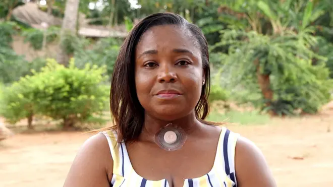 Mary Amankwah Fordwor, sage-femme principale à l'hôpital catholique St. Anthony au Ghana, a été diagnostiquée d'un cancer de la gorge en 2021.