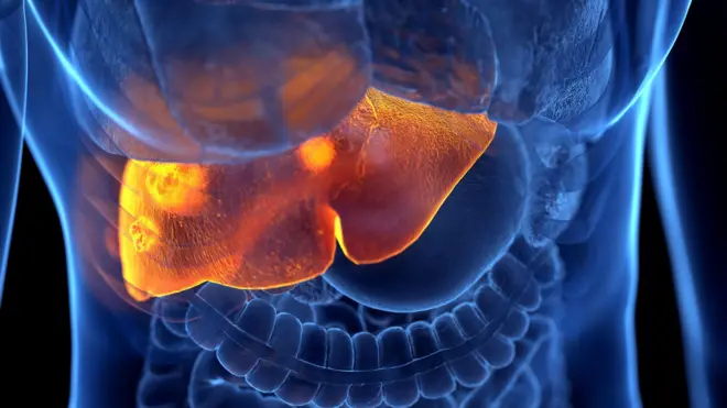 ग्राफिक्स 