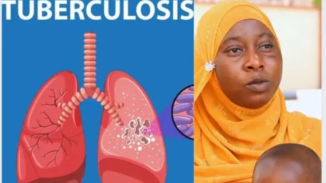 Obinrin ti ọmọ rẹ ni arun ikọ ise