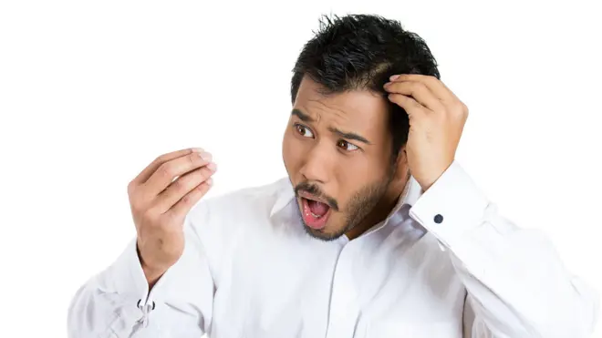 හිසකෙස් ගැලවී යාම පාරම්පරික විය හැකියි