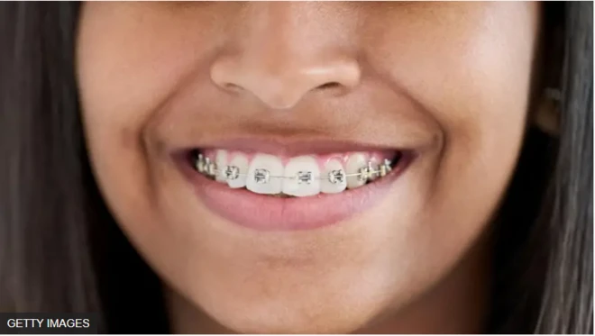 Irin igbalode ti won fi n satunto eyin