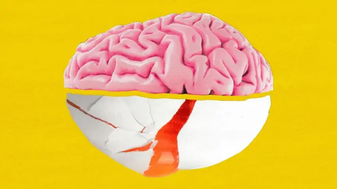 Image for a brain, on top of the a cracked egg with the yolk coming out over a yellow background 