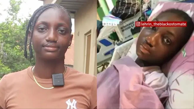 Aworan Tobilọba lori ibusun ni ileewosan ati aworan miran to duro