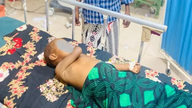 Wiilka yar ayaa maray ilaa saddex qaliin si loo dabiibo