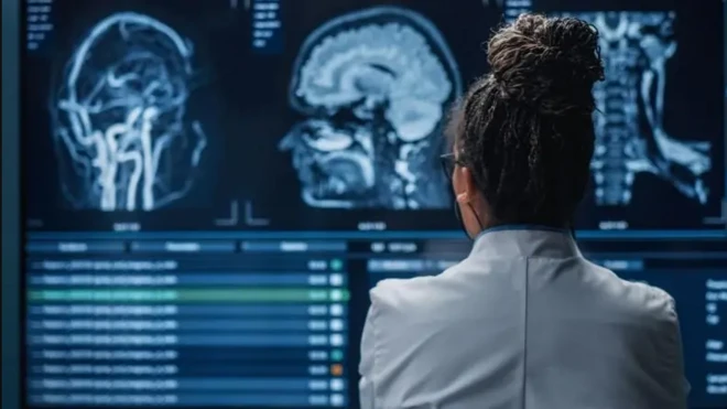 Aworan dokita to n wo ọpọlọ