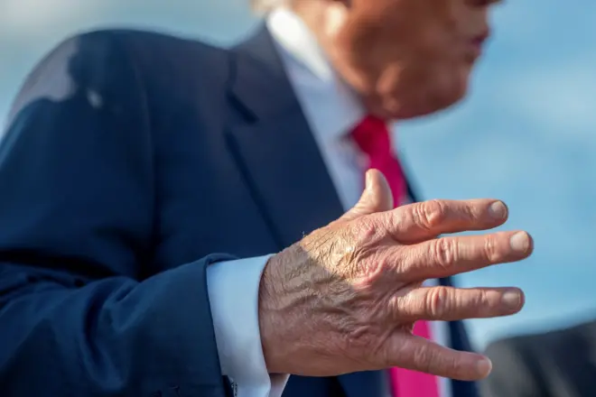 يغطي المكياج جزئياً الجزء الخلفي من اليد اليمنى للرئيس الأمريكي دونالد ترامب.