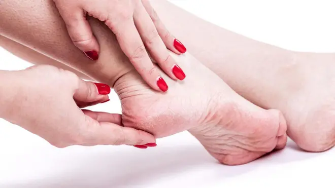 टाचांना भेगा पडणे ही एक सामान्य समस्या असली तरी, उपचार न केल्यास ती वेदनादायक ठरू शकते.