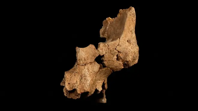 Фрагменты лицевой кости