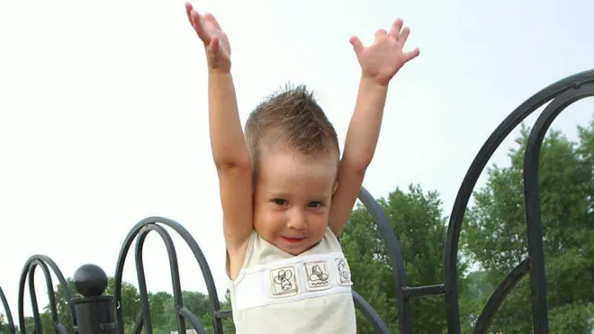 Хлопчик у білій майці тримає руки догори. На руках відсутні пальці 