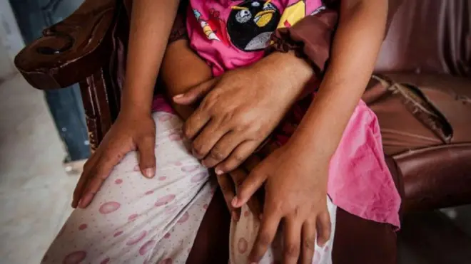 Foto ilustrasi korban kekerasan seksual pada anak. 