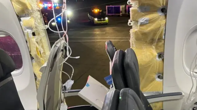 Xiyyaarri booyiing osoo balali'aa jiruu foddaa fi qaamni isaa irraa harca'e