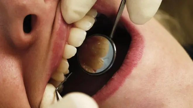 Close-up of a woman's open mouth, as a dentist examines her teeth with metallic tools
