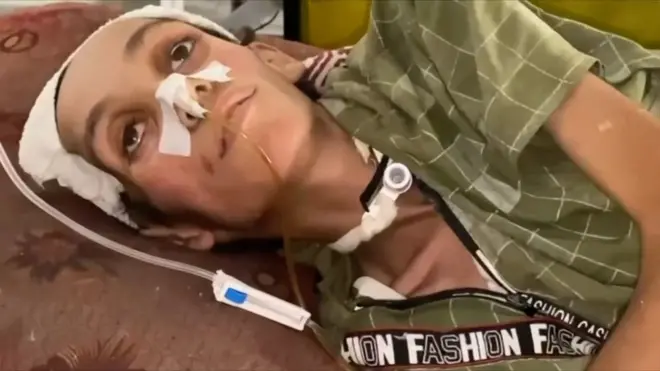 Izgladnelo dete iz Gaze