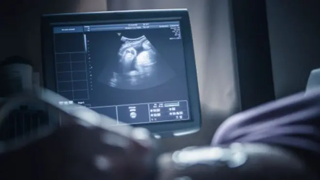 જોડિયાં બાળકોના ભૂણ પૈકી એકનો ગર્ભપાત કેટલો જોખમી?