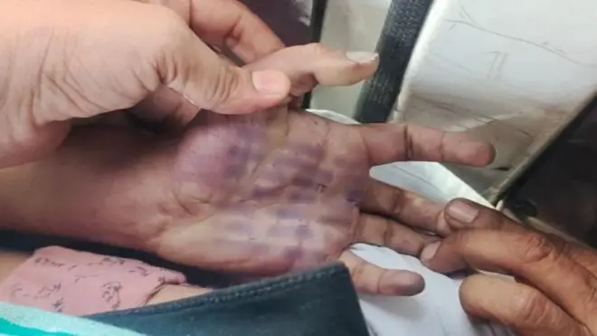 फलटणच्या डॉक्टर मृत्यू प्रकरणात कोणते 5 प्रश्न उपस्थित होत आहेत?