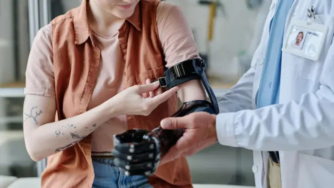 un doctor le coloca una protésis a una mujer con el brazo amputado. no se ven los rostros 
