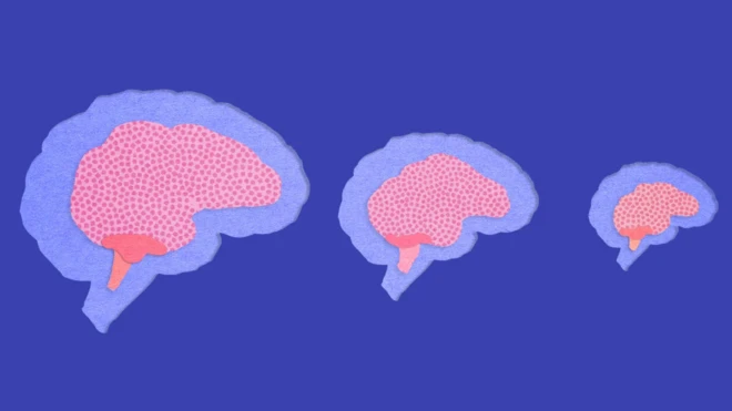 تصویرسازی از مراحل کوچکتر شدن مغز