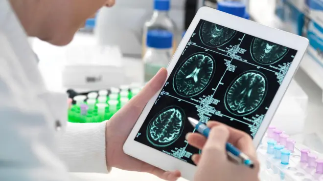 demans araştırmaları 