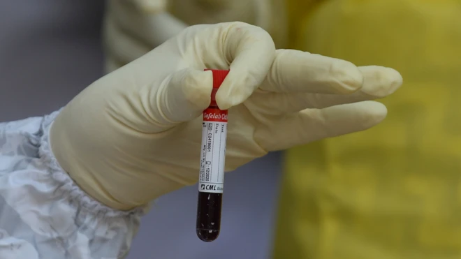 Blood test