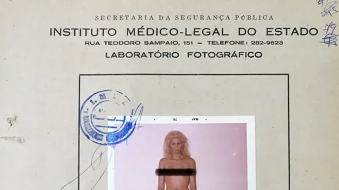 Fotografia de Waldirene em laudo do IML, feita em 1976; ela teve negado o pedido do habeas corpus preventivo para não ser submetida ao exame (a marca protegendo os seios foi feita pela BBC Brasil)
