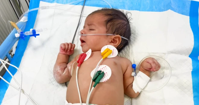 الرضيعة رهف على سريرها في قسم مخصص للعناية المركزة في مجمع ناصر الطبي للاستعانة بجهاز للتنفس في خان يونس جنوب قطاع غزة