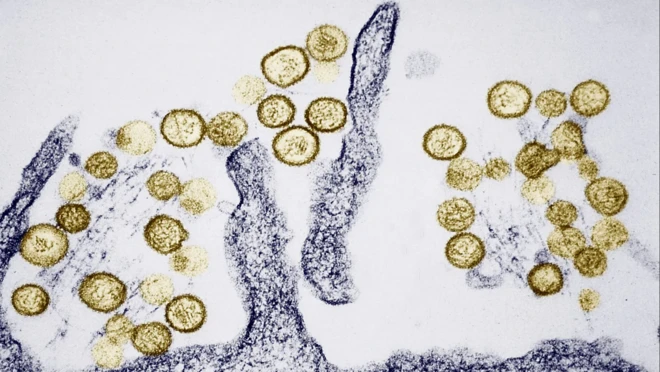 Outbreaks of the Sin Nombre hantavirus are now known to be linked to El Niño, which increases rainfall and boosts the population of its rodent hosts