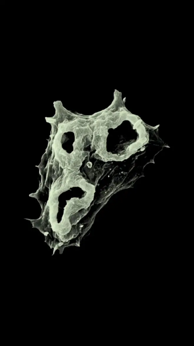 Ameba Naegleria fowleri