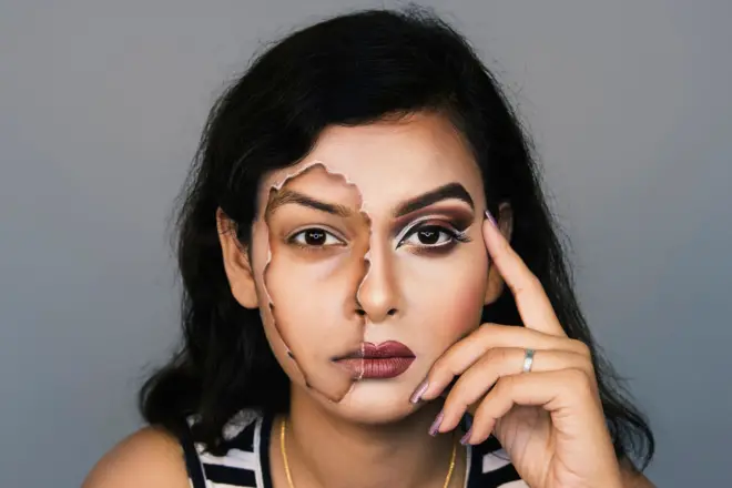 त्वचादानामुळं वाचवता येतात अनेकांचे जीव, पण प्रत्यक्षात जागरुकतेचा अभाव