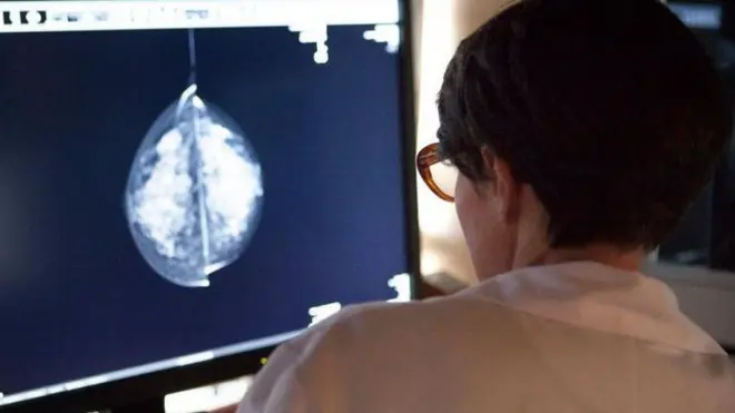 پزشکان در بیمارستان سلطنتی آبردین در اسکاتلند طی یک روند آزمایشی در تلاشند تا دریابد که هوش مصنوعی می‌تواند به رادیولوژیست‌ها در تشخیص سرطان پستان کمک کند یا خیر