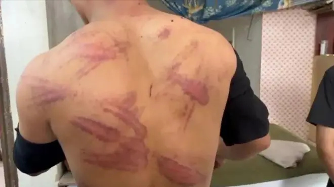 Baadhi ya Waafghanistan nchini Iran wameshutumiwa kwa ujasusi kufuatia mzozo wa siku 12 na Israel.