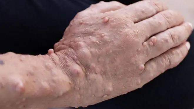 علامتی تصویر 